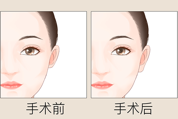 中國比較好的整形醫院排名第一
